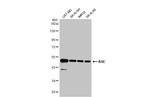 NSE Antibody in Western Blot (WB)