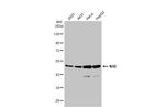 NSE Antibody in Western Blot (WB)