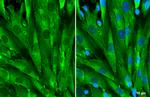 Galectin 1 Antibody in Immunocytochemistry (ICC/IF)