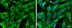 Galectin 1 Antibody in Immunocytochemistry (ICC/IF)