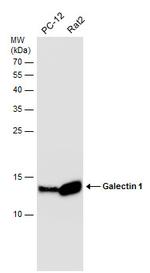 Galectin 1 Antibody in Western Blot (WB)