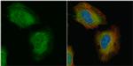 TAGLN Antibody in Immunocytochemistry (ICC/IF)