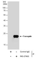 TAGLN Antibody in Immunoprecipitation (IP)