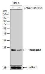 TAGLN Antibody