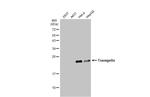 TAGLN Antibody in Western Blot (WB)