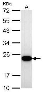 TAGLN Antibody in Western Blot (WB)