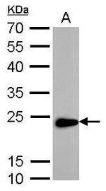 TAGLN Antibody in Western Blot (WB)