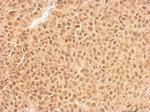 RPL11 Antibody in Immunohistochemistry (Paraffin) (IHC (P))