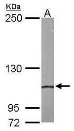 alpha Actinin 4 Antibody in Western Blot (WB)