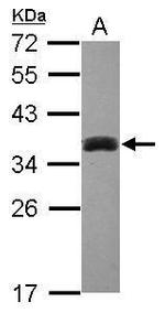 SULT1A3 Antibody in Western Blot (WB)