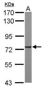 SDHA Antibody in Western Blot (WB)