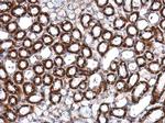 ILK Antibody in Immunohistochemistry (Paraffin) (IHC (P))