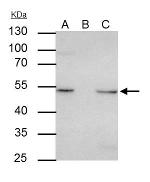 ILK Antibody in Immunoprecipitation (IP)