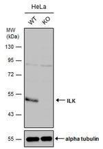 ILK Antibody