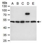 ILK Antibody in Western Blot (WB)