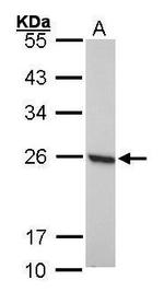 PRDX1 Antibody in Western Blot (WB)