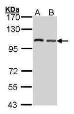 DAP5 Antibody in Western Blot (WB)