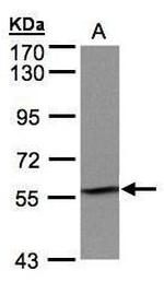 IMPDH2 Antibody in Western Blot (WB)