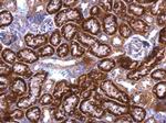 GDI1 Antibody in Immunohistochemistry (Paraffin) (IHC (P))