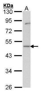 GDI1 Antibody in Western Blot (WB)