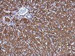 Ferritin Heavy Chain Antibody in Immunohistochemistry (Paraffin) (IHC (P))