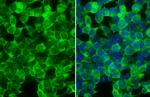 Creatine Kinase BB Antibody in Immunocytochemistry (ICC/IF)