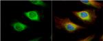 Creatine Kinase BB Antibody in Immunocytochemistry (ICC/IF)