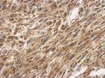 SLC25A11 Antibody in Immunohistochemistry (Paraffin) (IHC (P))