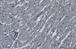 hnRNP K Antibody in Immunohistochemistry (Paraffin) (IHC (P))