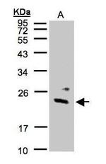 GUK1 Antibody in Western Blot (WB)