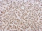 Ku70 Antibody in Immunohistochemistry (Paraffin) (IHC (P))