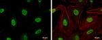 Ku70 Antibody in Immunocytochemistry (ICC/IF)