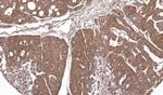 RPL5 Antibody in Immunohistochemistry (Paraffin) (IHC (P))