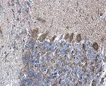 RPL5 Antibody in Immunohistochemistry (Paraffin) (IHC (P))