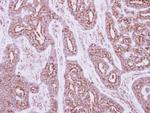 NDUFS5 Antibody in Immunohistochemistry (Paraffin) (IHC (P))