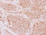 NDUFS5 Antibody in Immunohistochemistry (Paraffin) (IHC (P))