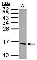 NDUFS5 Antibody in Western Blot (WB)