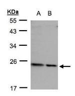 RPL17 Antibody in Western Blot (WB)