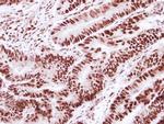 SNRPD2 Antibody in Immunohistochemistry (Paraffin) (IHC (P))