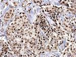 SNRPD2 Antibody in Immunohistochemistry (Paraffin) (IHC (P))