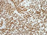 Ku70 Antibody in Immunohistochemistry (Paraffin) (IHC (P))