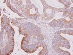 beta Tubulin 2 Antibody in Immunohistochemistry (Paraffin) (IHC (P))