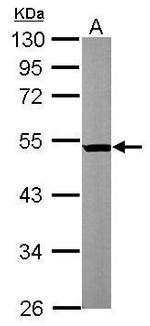 beta Tubulin 2 Antibody in Western Blot (WB)