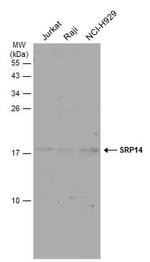 SRP14 Antibody in Western Blot (WB)