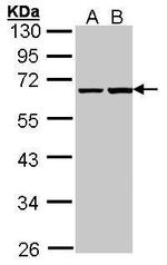 PHF1 Antibody in Western Blot (WB)