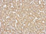 GOT2 Antibody in Immunohistochemistry (Paraffin) (IHC (P))