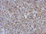 GOT2 Antibody in Immunohistochemistry (Paraffin) (IHC (P))