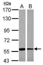 PHGDH Antibody in Western Blot (WB)