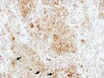 RAP1B Antibody in Immunohistochemistry (Paraffin) (IHC (P))