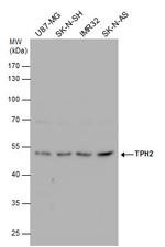 TPH2 Antibody in Western Blot (WB)